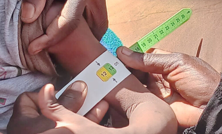 سوء التغذية الحاد بشمال دارفور