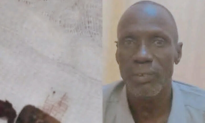 في جنوب السودان استخراج رصاصة من جسده رجل ظلت فيه لمدة 40 عاما